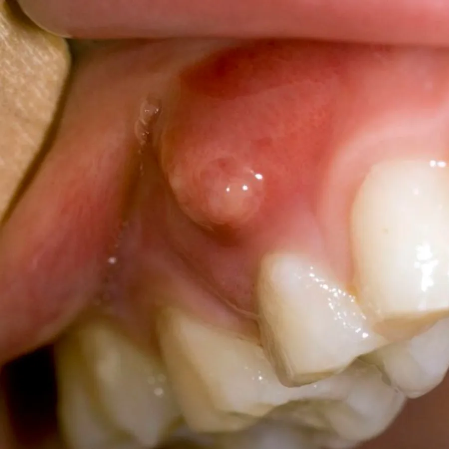 Emergencias endodónticas y atención dental urgente en MAS Healthcare