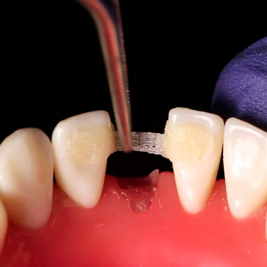 Rehabilitación oclusal y función masticatoria